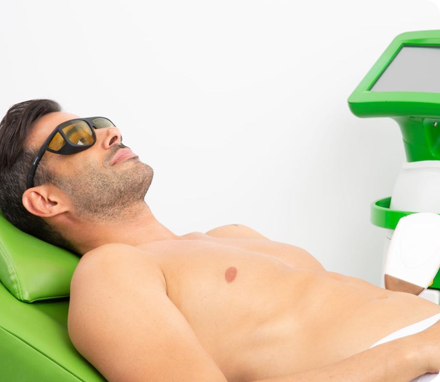Depilación láser para hombre de cuerpo completo