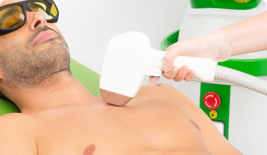 Zona de pecho y abdomen para depilación láser